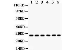 Anti- CIB1 Picoband antibody, Western blotting All lanes: Anti CIB1  at 0. (CIB1 antibody  (AA 6-191))