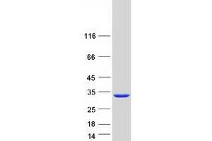 Validation with Western Blot (PSPH Protein (Myc-DYKDDDDK Tag))