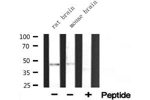 Western blot analysis of extracts of various tissue ,using ACAT1 antibody. (ACAT1 antibody  (Internal Region))