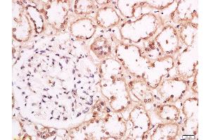 Immunohistochemistry (Paraffin-embedded Sections) (IHC (p)) image for anti-CREB Regulated Transcription Coactivator 1 (CRTC1) (pSer151) antibody (ABIN746558)