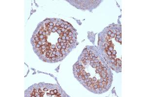 Immunohistochemistry of paraffin-embedded rat testis using KIF3A Rabbit mAb (ABIN7268132) at dilution of 1:100 (40x lens). (KIF3A antibody)