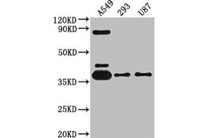 Western Blot Positive WB detected in: A549 whole cell lysate, 293 whole cell lysate, U87 whole cell lysate All lanes: ADORA1 antibody at 1:2000 Secondary Goat polyclonal to rabbit IgG at 1/50000 dilution Predicted band size: 37, 14 kDa Observed band size: 37 kDa (Recombinant ADORA1 antibody)