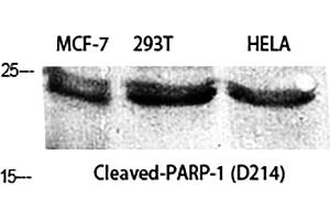 Western Blot analysis of MCF-7 (1), 293T (2), Hela (3), diluted at 1:2000. (PARP1 antibody  (Cleaved-Asp214))