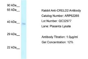 Western Blotting (WB) image for anti-Cysteine-Rich with EGF-Like Domains 2 (CRELD2) (C-Term) antibody (ABIN2789088) (CRELD2 antibody  (C-Term))