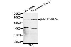 Western blot analysis of extracts of 293 cells, using Phospho-AKT2-S474 antibody (ABIN5969868). (AKT2 antibody  (pSer474))