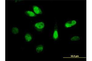 Immunofluorescence of purified MaxPab antibody to CDKN3 on HeLa cell. (CDKN3 antibody  (AA 1-212))