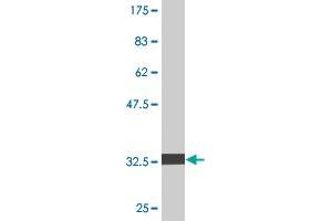 Western Blot detection against Immunogen (33. (PIGS antibody  (AA 450-518))
