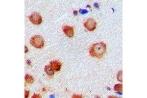 Immunohistochemical analysis of CDK6 staining in human brain formalin fixed paraffin embedded tissue section. (CDK6 antibody)