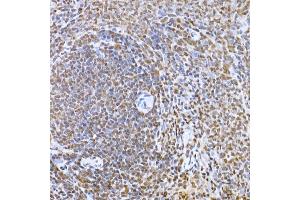 Immunohistochemistry of paraffin-embedded rat spleen using Snail Rabbit pAb (ABIN1682836, ABIN3019402, ABIN3019403, ABIN3019404 and ABIN6220883) at dilution of 1:150 (40x lens). (SNAIL antibody  (AA 1-100))