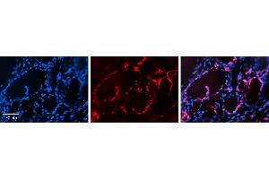 Rabbit Anti-PAX8 Antibody Catalog Number: ARP34180_P050 Formalin Fixed Paraffin Embedded Tissue: Human Thyroid Tissue Observed Staining: Nucleus in follicular cells Primary Antibody Concentration: N/A Other Working Concentrations: 1:600 Secondary Antibody: Donkey anti-Rabbit-Cy3 Secondary Antibody Concentration: 1:200 Magnification: 20X Exposure Time: 0. (PAX8 antibody  (C-Term))