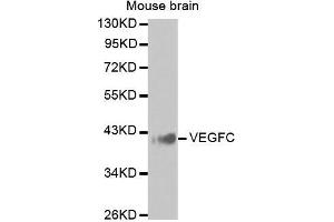 Western Blotting (WB) image for anti-Vascular Endothelial Growth Factor C (VEGFC) antibody (ABIN3023364)