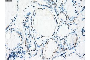 Immunohistochemical staining of paraffin-embedded Ovary tissue using anti-CRYABmouse monoclonal antibody. (CRYAB antibody)