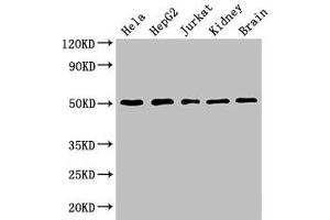 Western Blot Positive WB detected in: Hela whole cell lysate, HepG2 whole cell lysate, Jurkat whole cell lysate, Mouse kidney tissue, Mouse brain tissue All lanes: TUBA3C antibody at 3 μg/mL Secondary Goat polyclonal to rabbit IgG at 1/50000 dilution Predicted band size: 50, 47 kDa Observed band size: 50 kDa (TUBA3C antibody  (AA 161-418))