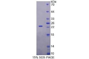 SDS-PAGE (SDS) image for Retinol Binding Protein 5, Cellular (RBP5) (AA 19-201) protein (His tag) (ABIN1080664) (Retinol Binding Protein 5 Protein (AA 19-201) (His tag))