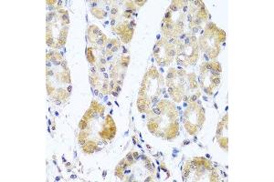 Immunohistochemistry of paraffin-embedded human stomach using MRPL11 antibody. (MRPL11 antibody  (AA 1-192))