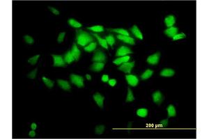 Immunofluorescence of monoclonal antibody to SGTA on HeLa cell. (SGTA antibody  (AA 42-123))
