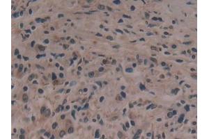 Immunohistochemistry (IHC) image for anti-Anoctamin 6 (ANO6) (AA 744-824) antibody (ABIN7436141)
