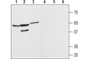 Western blot analysis of rat brain (lanes 1 and 4) kidney (lanes 2 and 5) and heart (lanes 3 and 6) membranes: - 1-3. (MAS1 antibody  (AA 212-224))