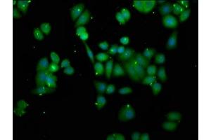 Immunofluorescence staining of PC-3 cells with ABIN7162284 at 1:166, counter-stained with DAPI. (ORMDL3 antibody  (AA 43-94))