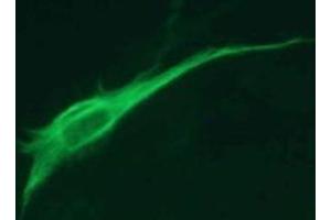 Immunofluorescence (IF) image for anti-Glial Fibrillary Acidic Protein (GFAP) antibody (ABIN1449150)