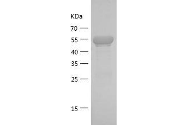 NFKBIA Protein (AA 7-266) (GST tag)