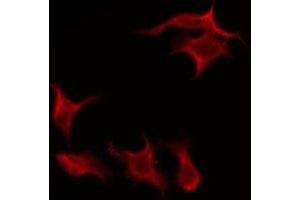 ABIN6275879 staining Hela by IF/ICC. (FCRL5 antibody  (Internal Region))