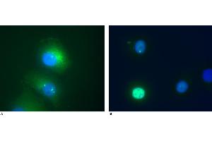 Immunocytochemistry staining of Daxx in transfected HeLa human cervix carcinoma cell line. (DAXX antibody  (AA 558-740))