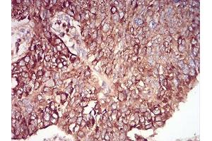 Immunohistochemistry (IHC) image for anti-RAB6B, Member RAS Oncogene Family (RAB6B) (AA 95-208) antibody (ABIN5542692)