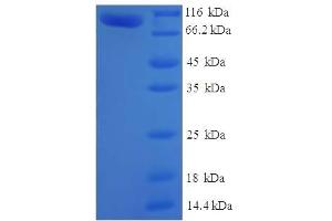 SDS-PAGE (SDS) image for Myotubularin Related Protein 7 (MTMR7) (AA 1-660), (full length) protein (His-SUMO Tag) (ABIN4975885)