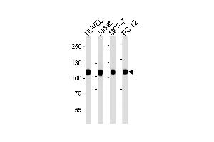Western blot analysis of lysates from HUVEC, Jurkat, MCF-7, PC-12 cell line (from left to right), using TOP1 Antibody (N-term) (ABIN1882055 and ABIN2838496).