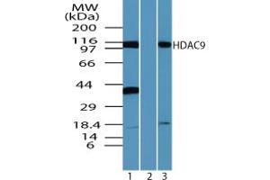 Image no. 2 for anti-Histone Deacetylase 9 (HDAC9) (AA 100-150) antibody (ABIN960197) (HDAC9 antibody  (AA 100-150))