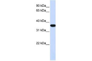 Heme Oxygenase antibody used at 1 ug/ml to detect target protein.
