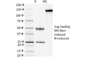 SDS-PAGE Analysis Purified CD3e Mouse Monoclonal Antibody (PC3/188A). (CD3 epsilon antibody  (Cytoplasmic Domain))