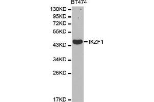 Western blot analysis of extracts of BT474 cell lines, using IKZF1 antibody.