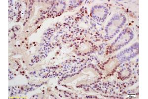 Immunohistochemistry (IHC) image for anti-Histone 3 (H3) (AA 71-136) antibody (ABIN739109)