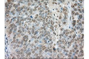 Immunohistochemical staining of paraffin-embedded colon tissue using anti-TACC3 mouse monoclonal antibody. (TACC3 antibody)