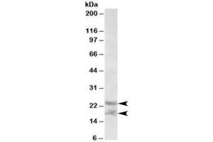 Western blot testing of human prostate lysate with IL-25 antibody at 0. (IL-25 antibody)