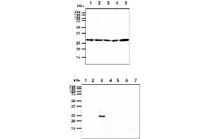 The cell lysates (40ug) were resolved by SDS-PAGE, transferred to PVDF membrane and probed with anti-human 14-3-3 epsilon antibody (1:1000). (YWHAE antibody)