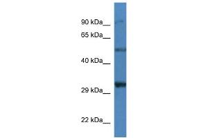 WB Suggested Anti-Sgcd Antibody   Titration: 1. (SGCD antibody  (N-Term))