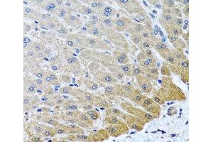 Immunohistochemistry of paraffin-embedded Human liver using ARSF Polyclonal Antibody at dilution of 1:100 (40x lens). (ARSF antibody)