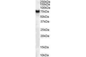 ABIN2562711 (1µg/ml) staining of human pancreas lysate (35µg protein in RIPA buffer). (FZD8 antibody  (C-Term))