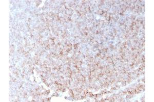 Immunohistochemistry (IHC) image for anti-Complement Component (3d/Epstein Barr Virus) Receptor 2 (CR2) (AA 44-196) antibody (ABIN6939181)