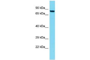 Host: Rabbit Target Name: DPY19L3 Sample Type: Jurkat Whole Cell lysates Antibody Dilution: 1. (DPY19L3 antibody  (C-Term))