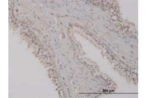 Immunoperoxidase of monoclonal antibody to ST8SIA2 on formalin-fixed paraffin-embedded human prostate. (ST8SIA2 antibody  (AA 40-146))