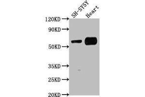 Western Blot Positive WB detected in: SH-SY5Y whole cell lysate, Mouse heart tissue All lanes: JRK antibody at 1:1000 Secondary Goat polyclonal to rabbit IgG at 1/50000 dilution Predicted band size: 62, 63 kDa Observed band size: 62 kDa (JRK antibody  (AA 465-483))