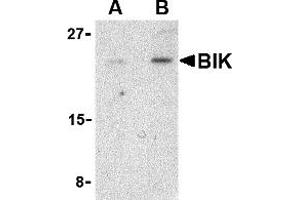 Western Blotting (WB) image for anti-BCL2-Interacting Killer (Apoptosis-Inducing) (BIK) (N-Term) antibody (ABIN1031274) (BIK antibody  (N-Term))