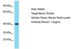 Image no. 1 for anti-Ribosomal Modification Protein RimK-Like Family Member B (RIMKLB) (AA 41-90) antibody (ABIN6750385) (RIMKLB antibody  (AA 41-90))