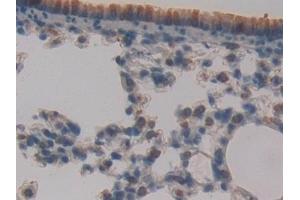 Detection of ATM in Mouse Lung Tissue using Polyclonal Antibody to Ataxia Telangiectasia Mutated (ATM) (ATM antibody  (AA 486-742))