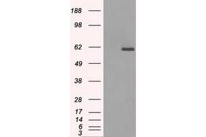 Image no. 1 for anti-Protein Phosphatase 5, Catalytic Subunit (PPP5C) antibody (ABIN1500392) (PP5 antibody)