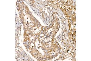 Immunohistochemistry (IHC) image for anti-Numb Homolog (NUMB) (AA 521-640) antibody (ABIN6144943)